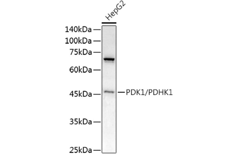 Western Blot - Anti-PDK1 Antibody (A11200) - Antibodies.com