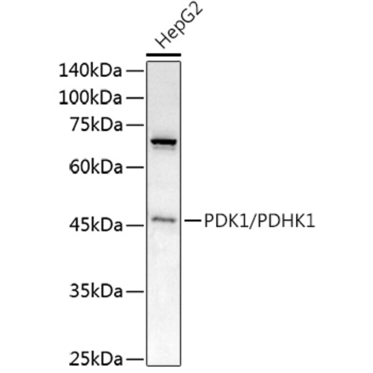 Western Blot - Anti-PDK1 Antibody (A11200) - Antibodies.com