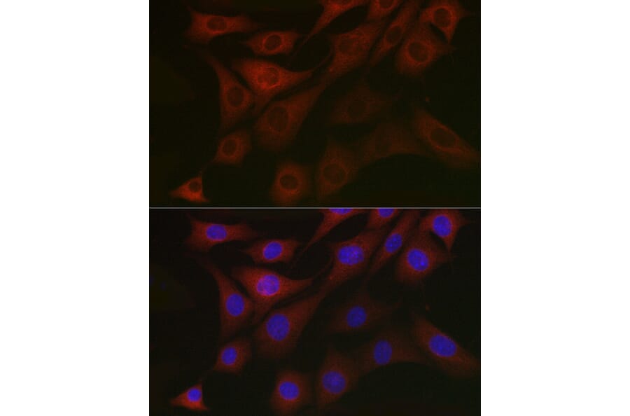 Immunofluorescence - Anti-PDK1 Antibody (A11200) - Antibodies.com