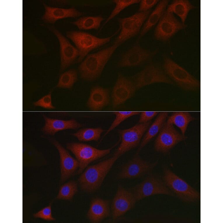 Immunofluorescence - Anti-PDK1 Antibody (A11200) - Antibodies.com