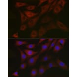 Immunofluorescence - Anti-PDK1 Antibody (A11200) - Antibodies.com