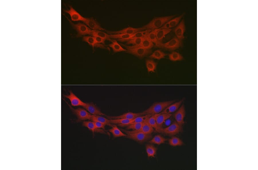 Immunofluorescence - Anti-PDK1 Antibody (A11200) - Antibodies.com