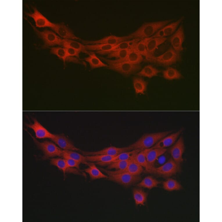 Immunofluorescence - Anti-PDK1 Antibody (A11200) - Antibodies.com