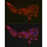 Immunofluorescence - Anti-PDK1 Antibody (A11200) - Antibodies.com