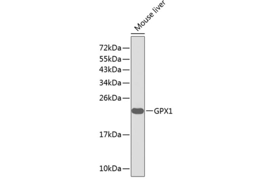 Western Blot - Anti-GPX1 Antibody (A0873) - Antibodies.com