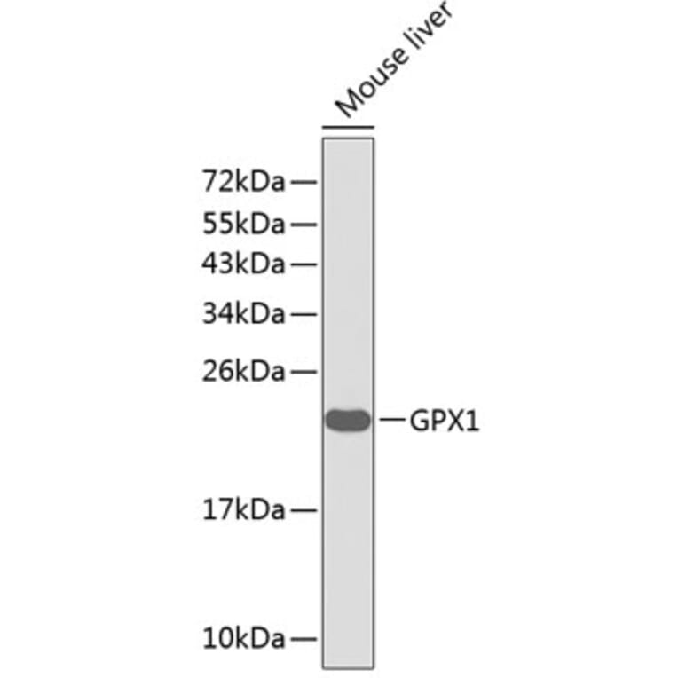 Western Blot - Anti-GPX1 Antibody (A0873) - Antibodies.com