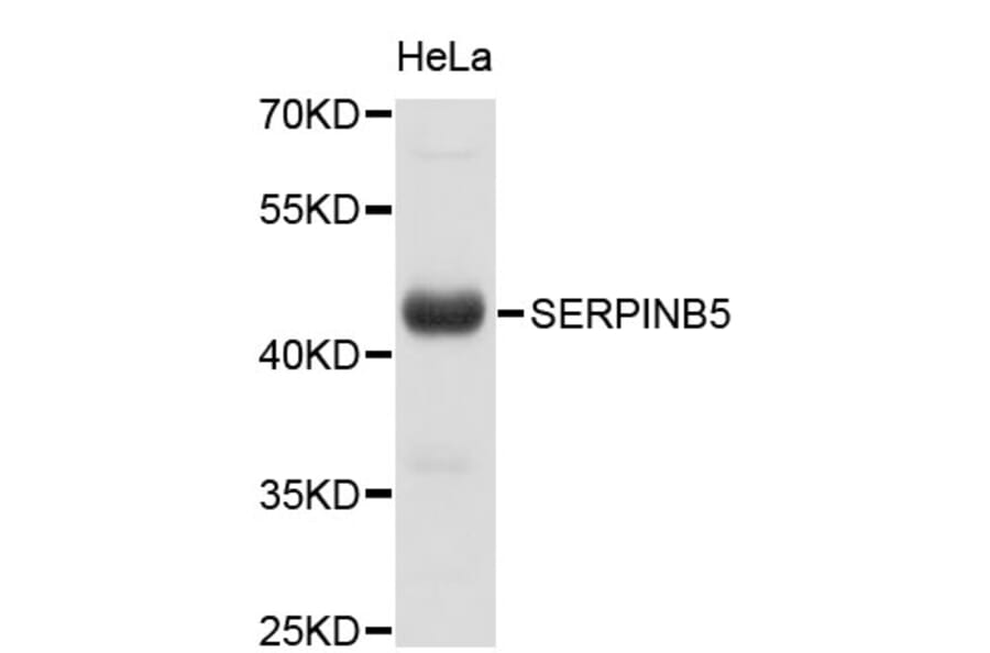 Western Blot - Anti-SERPINB5 Antibody (A0882) - Antibodies.com