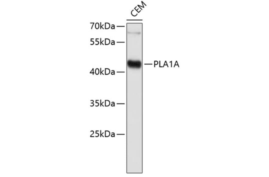 Western Blot - Anti-PLA1A Antibody (A0939) - Antibodies.com