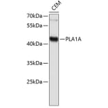 Western Blot - Anti-PLA1A Antibody (A0939) - Antibodies.com