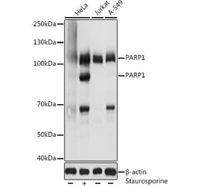 Western Blot - Anti-PARP1 Antibody (A11205) - Antibodies.com