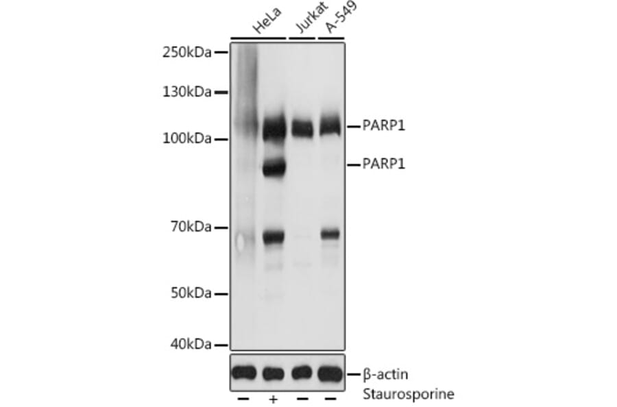 Western Blot - Anti-PARP1 Antibody (A11205) - Antibodies.com