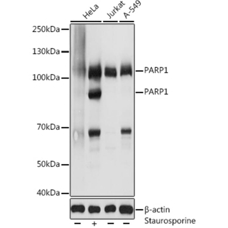 Western Blot - Anti-PARP1 Antibody (A11205) - Antibodies.com