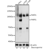 Western Blot - Anti-PARP1 Antibody (A11205) - Antibodies.com
