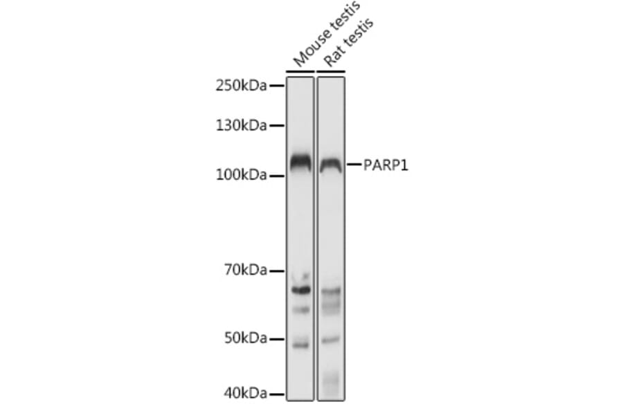 Western Blot - Anti-PARP1 Antibody (A11205) - Antibodies.com