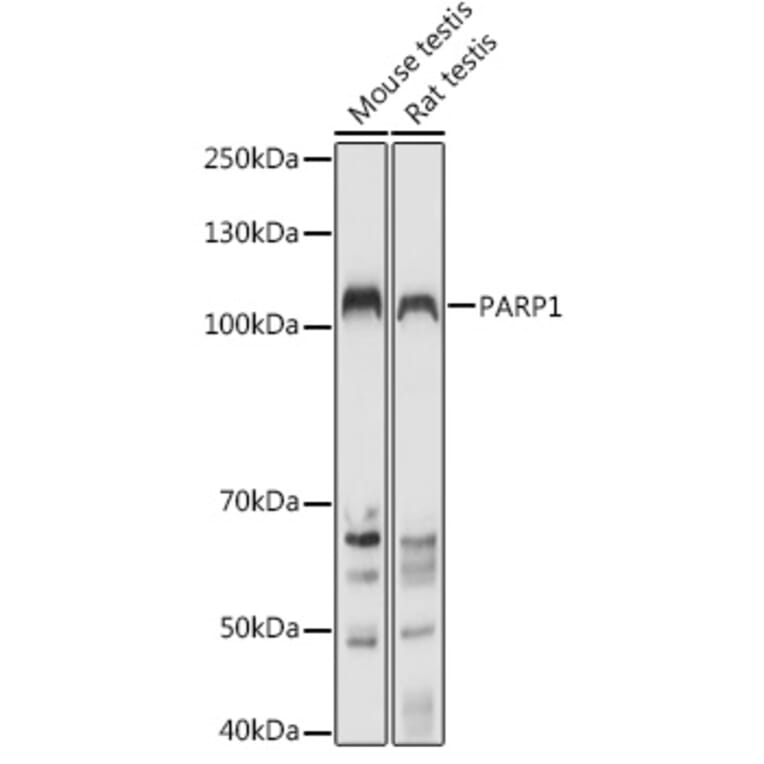 Western Blot - Anti-PARP1 Antibody (A11205) - Antibodies.com