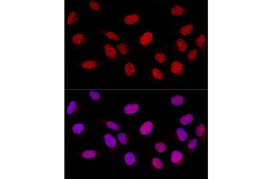 Immunofluorescence - Anti-PARP1 Antibody (A11205) - Antibodies.com