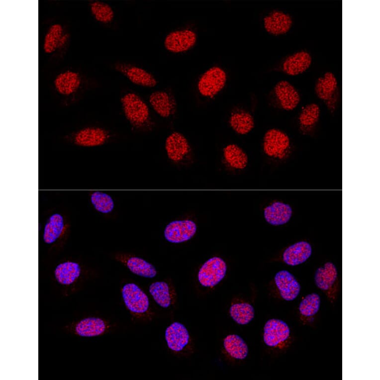 Immunofluorescence - Anti-PARP1 Antibody (A11205) - Antibodies.com