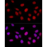 Immunofluorescence - Anti-PARP1 Antibody (A11205) - Antibodies.com