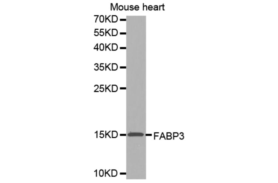 Western Blot - Anti-FABP3 Antibody (A0946) - Antibodies.com