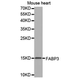 Western Blot - Anti-FABP3 Antibody (A0946) - Antibodies.com