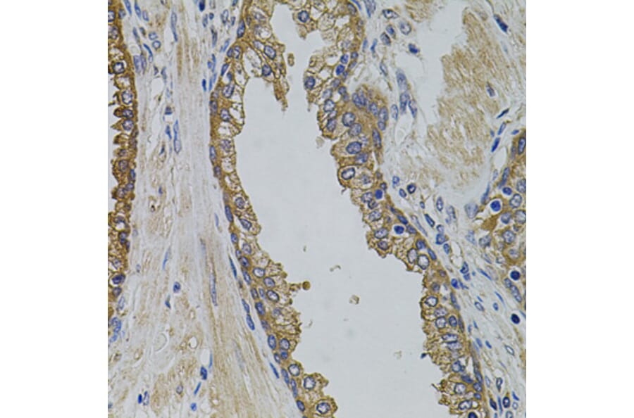 Immunohistochemistry - Anti-PIK3C3 Antibody (A0952) - Antibodies.com