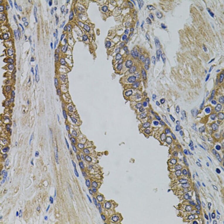 Immunohistochemistry - Anti-PIK3C3 Antibody (A0952) - Antibodies.com
