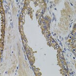 Immunohistochemistry - Anti-PIK3C3 Antibody (A0952) - Antibodies.com