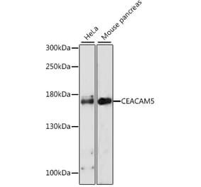 Western Blot - Anti-CEACAM5 Antibody (A11210) - Antibodies.com
