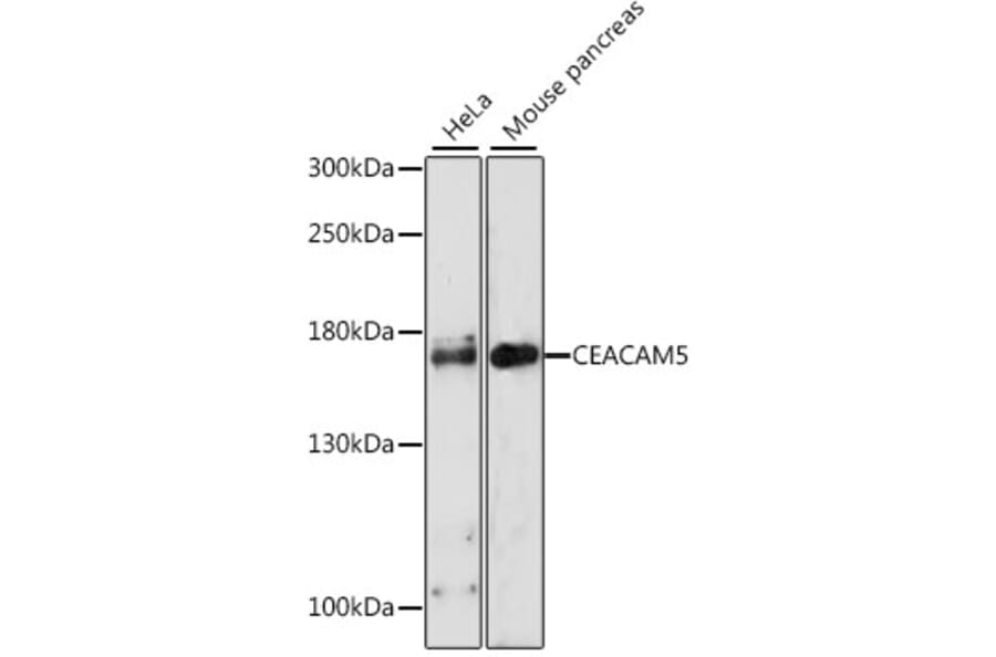 Western Blot - Anti-CEACAM5 Antibody (A11210) - Antibodies.com