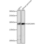 Western Blot - Anti-CEACAM5 Antibody (A11210) - Antibodies.com