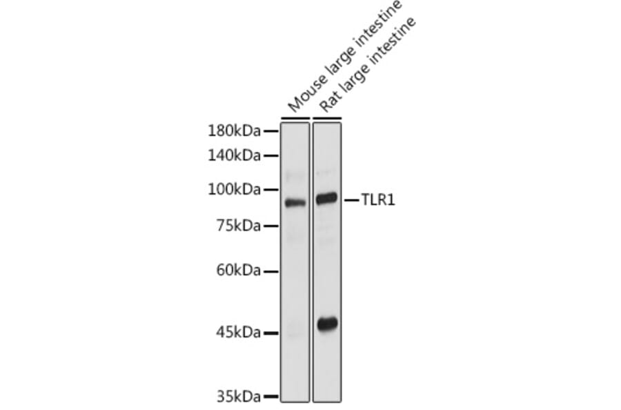 Western Blot - Anti-TIL/TLR1 Antibody (A11211) - Antibodies.com