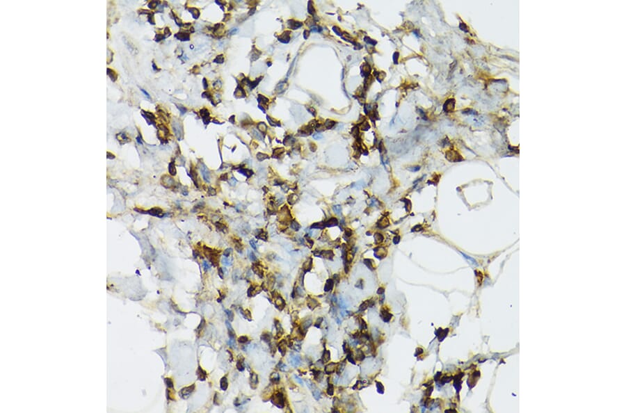Immunohistochemistry - Anti-TIL/TLR1 Antibody (A11211) - Antibodies.com