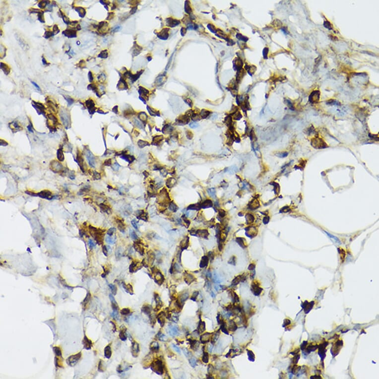 Immunohistochemistry - Anti-TIL/TLR1 Antibody (A11211) - Antibodies.com