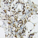 Immunohistochemistry - Anti-TIL/TLR1 Antibody (A11211) - Antibodies.com
