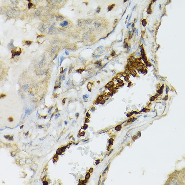 Immunohistochemistry - Anti-TIL/TLR1 Antibody (A11211) - Antibodies.com