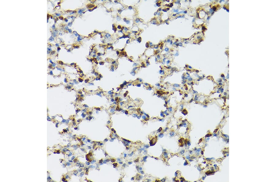 Immunohistochemistry - Anti-TIL/TLR1 Antibody (A11211) - Antibodies.com