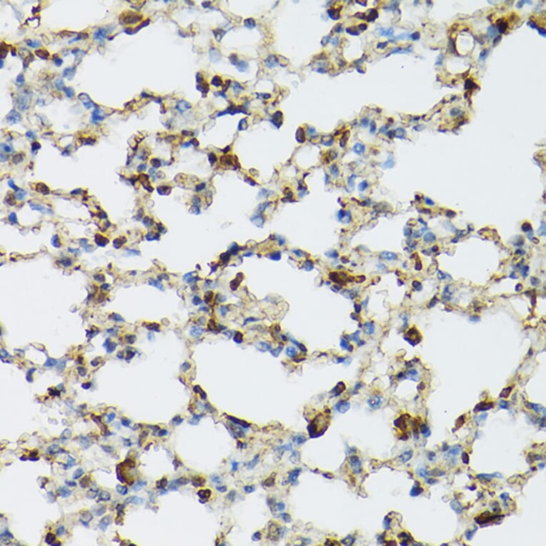 Immunohistochemistry - Anti-TIL/TLR1 Antibody (A11211) - Antibodies.com