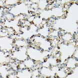 Immunohistochemistry - Anti-TIL/TLR1 Antibody (A11211) - Antibodies.com