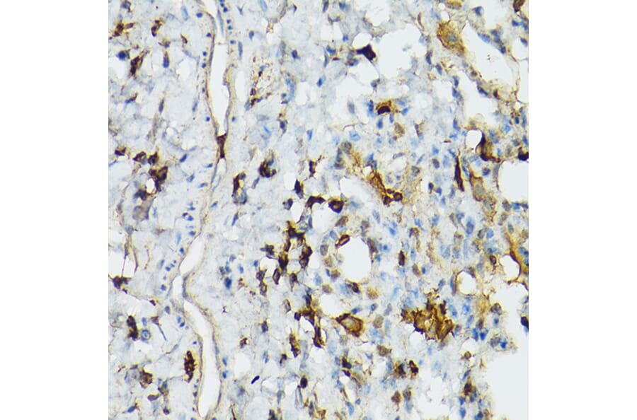 Immunohistochemistry - Anti-TIL/TLR1 Antibody (A11211) - Antibodies.com