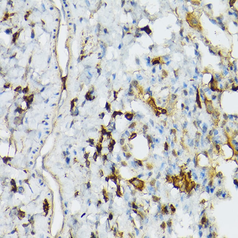 Immunohistochemistry - Anti-TIL/TLR1 Antibody (A11211) - Antibodies.com