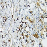 Immunohistochemistry - Anti-TIL/TLR1 Antibody (A11211) - Antibodies.com