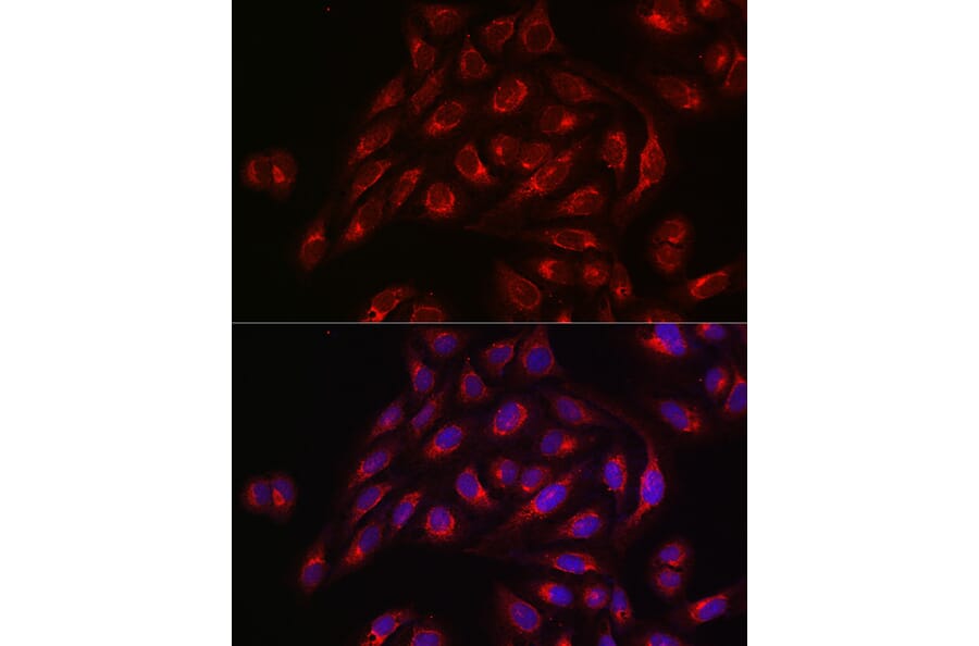 Immunofluorescence - Anti-TIL/TLR1 Antibody (A11211) - Antibodies.com