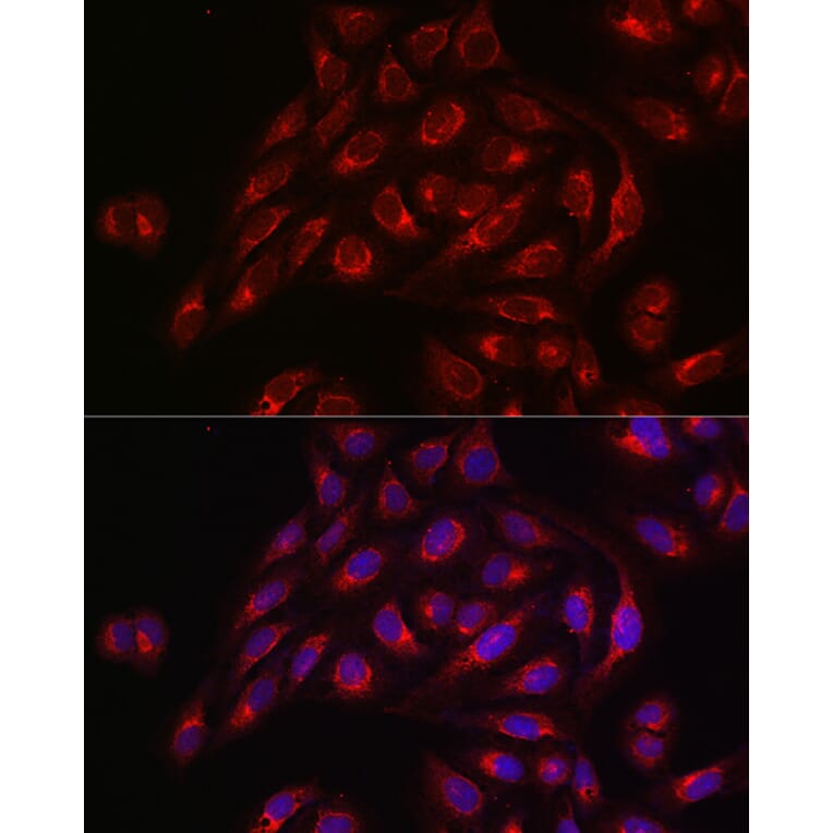 Immunofluorescence - Anti-TIL/TLR1 Antibody (A11211) - Antibodies.com
