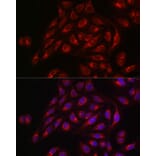 Immunofluorescence - Anti-TIL/TLR1 Antibody (A11211) - Antibodies.com