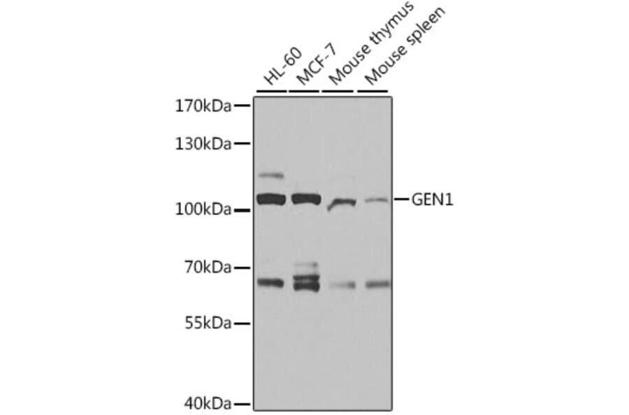 Western Blot - Anti-GEN1 Antibody (A11212) - Antibodies.com