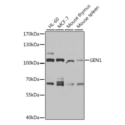 Western Blot - Anti-GEN1 Antibody (A11212) - Antibodies.com