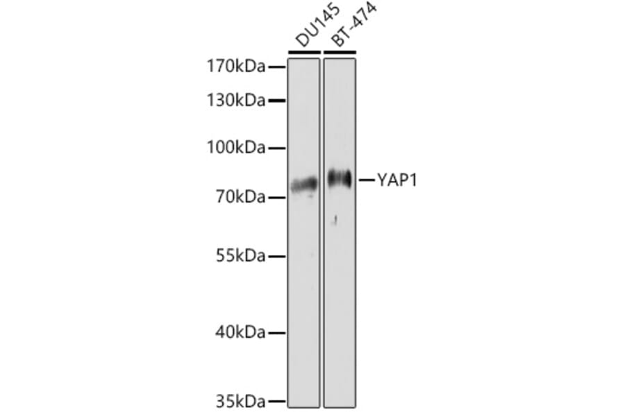 Western Blot - Anti-YAP1 Antibody (A11213) - Antibodies.com