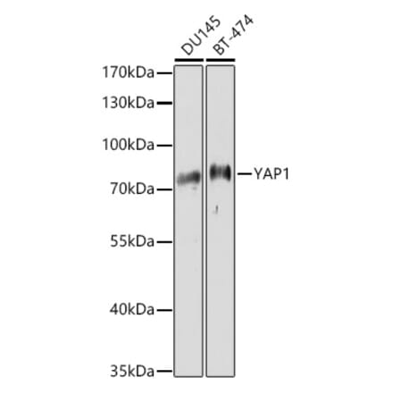 Western Blot - Anti-YAP1 Antibody (A11213) - Antibodies.com