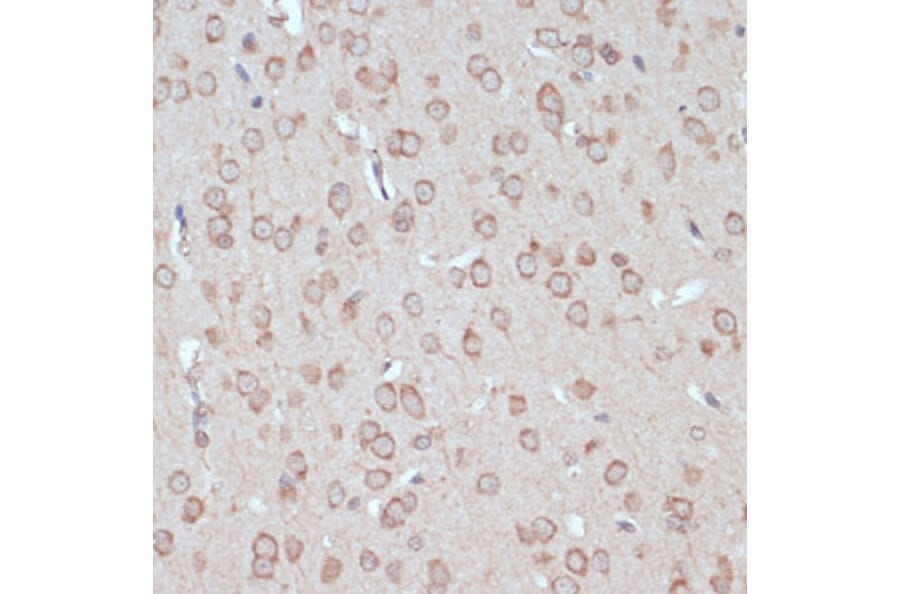 Immunohistochemistry - Anti-YAP1 Antibody (A11213) - Antibodies.com