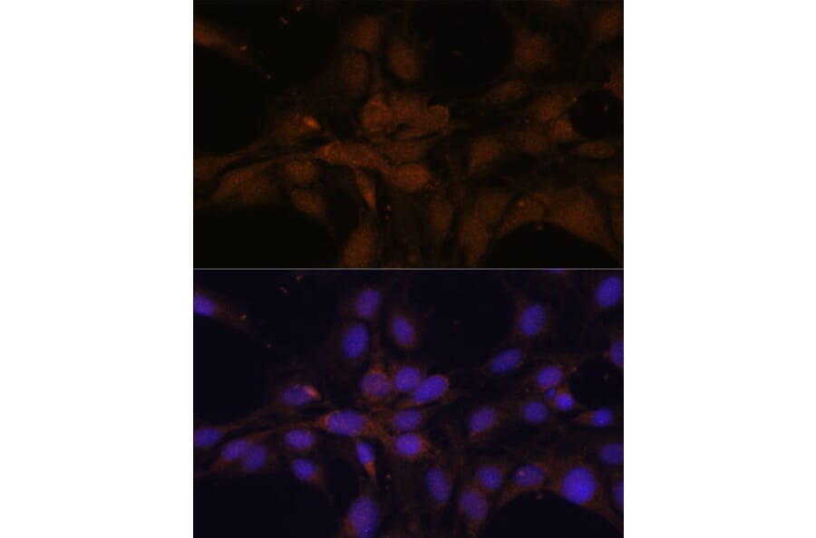 Immunofluorescence - Anti-YAP1 Antibody (A11213) - Antibodies.com